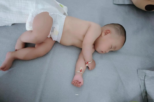 潜江宝宝脸上有白色斑块